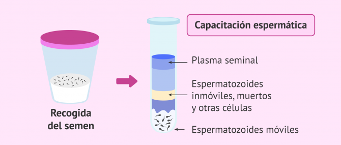 Imagen: obtencion-preparacion-semen