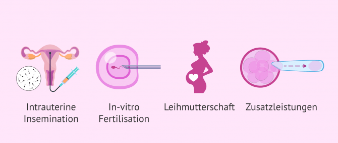 Imagen: Optionen bei Kinderwunschbehandlungen