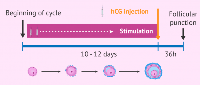 Imagen: Ovarian stimulation for egg donation