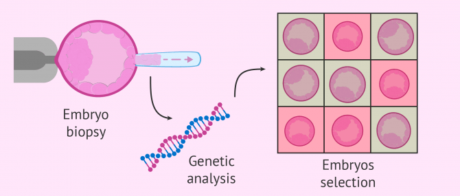 Imagen: PGD to blastocyst