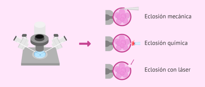 Imagen: Tres métodos para hacer el hatching asistido