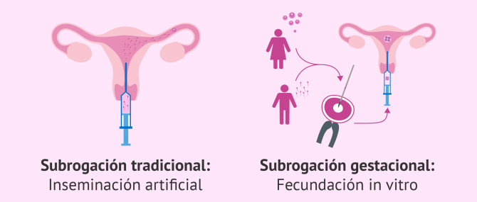 Gestación subrogada tradicional y subrogación gestacional