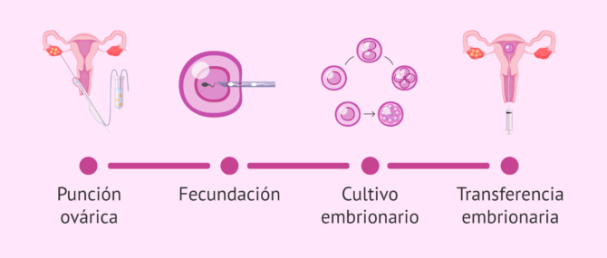 Imagen: ¿Cómo es el proceso de la FIV convencional o ICSI?
