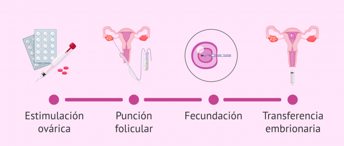 Imagen: Proceso de la FIV paso a paso