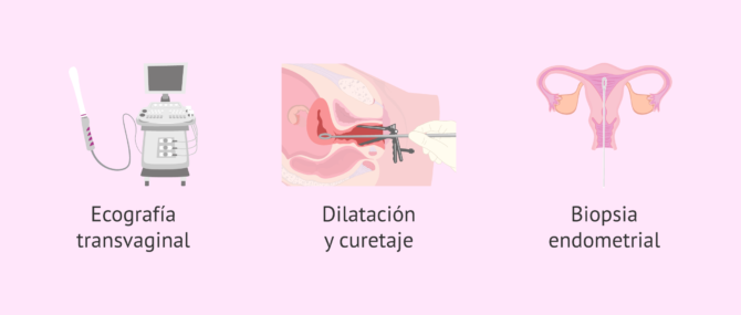 Imagen: pruebas-diagnosticas-cancer-cuello-uterino
