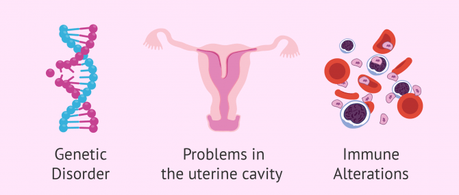 Imagen: Reasons for Recurrent Miscarriage