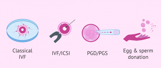 Reproductive technologies used in surrogacy
