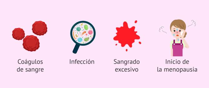 Imagen: Tener hijos después de la histerectomia