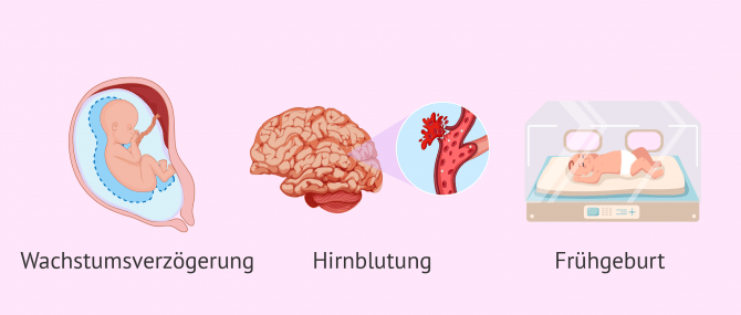 Imagen: Komplikationen bei der Schwangerschaft aufgrund von Herzkreislauferkrankungen
