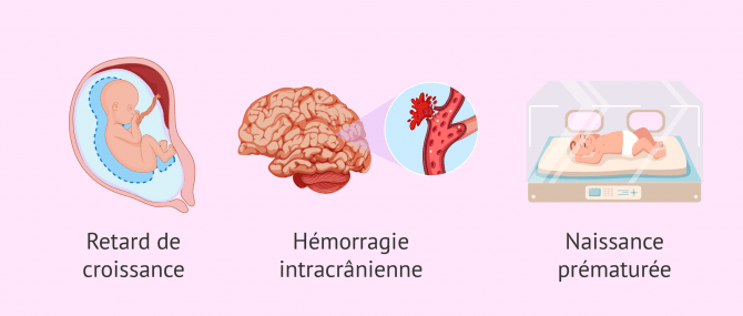 Imagen: risques maladies cardiovasculaires