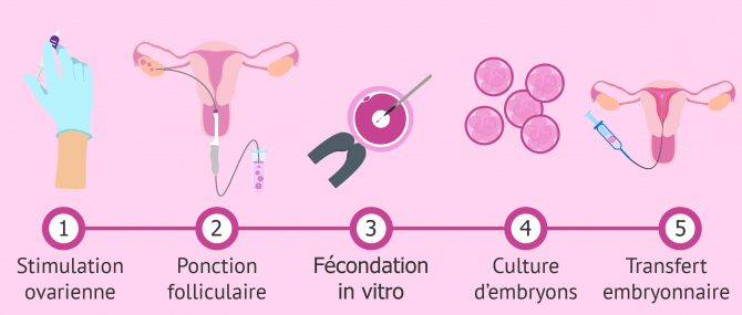 Rôle de la clinique de fertilité dans une GPA: examens médicaux et FIV