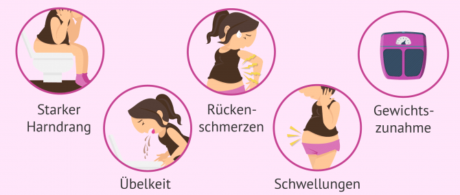 Imagen: Die häufigsten Schwangerschaftssymptome
