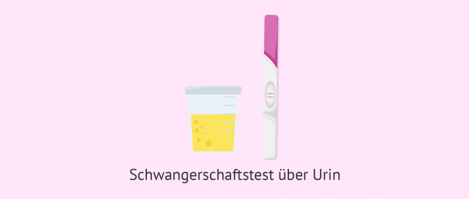 Imagen: Schwangerschaftstest über Urin