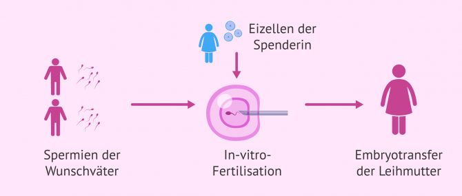 Imagen: Biologische Eltern werden bei homosexuellen Pärchen
