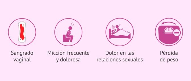 Imagen: Cáncer de útero