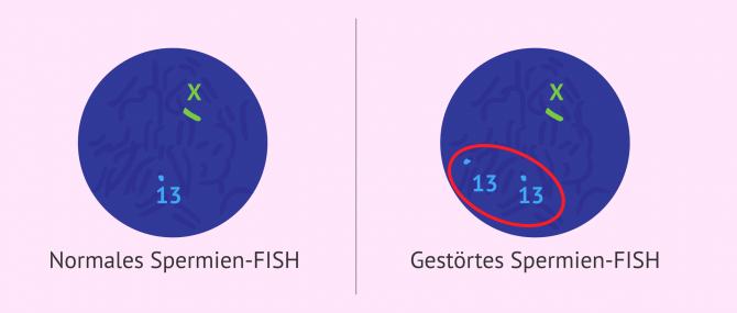 Imagen: In-situ-Hybridisierung oder FISH von Spermien