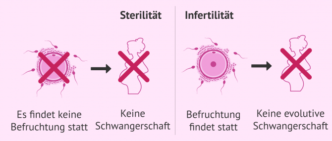 Imagen: Unterschiede zwischen Sterilität und Infertilität