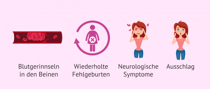 Imagen: Antiphospholipid-Syndrom: Symptome