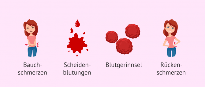 Imagen: Klinische Erscheinungsformen bei biochemischer Schwangerschaft