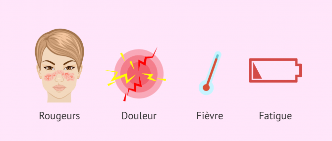 Imagen: symptômes et signes maladie auto-immunes