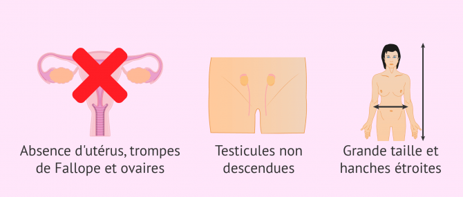 Imagen: symptômes du syndrome de Morris