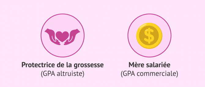 Imagen: terminologie GPA en Hongrie
