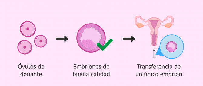 Imagen: Riesgos del embarazo para la gestante