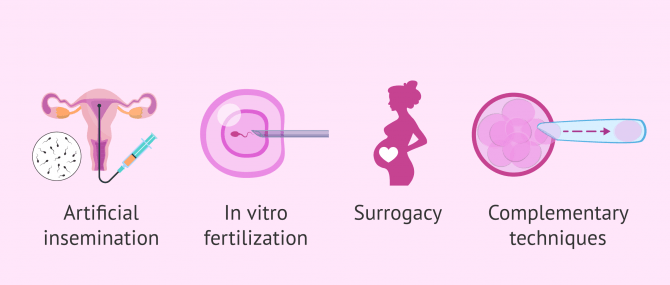 Imagen: Infertility treatment options