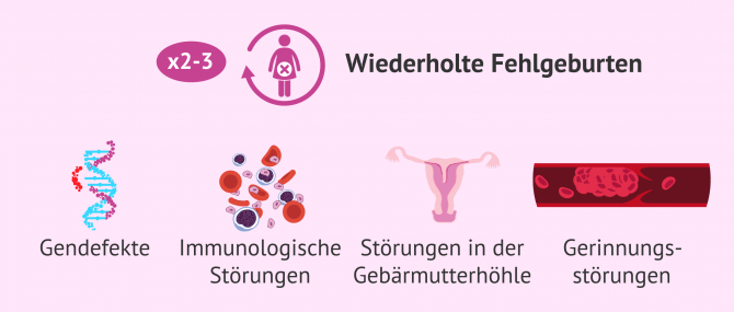 Imagen: Fehlgeburten haben unterschiedliche Ursachen