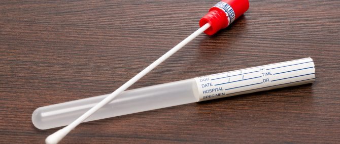 Imagen: DNA-Probe um die Vaterschaft zu bestimmen