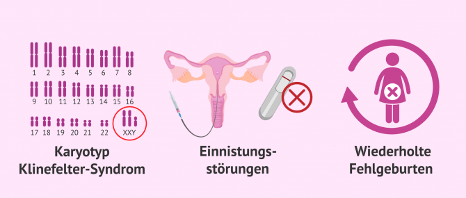 Imagen: Wann die PID verwendet wird