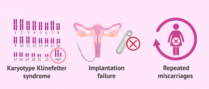 Imagen: Indications of PGD