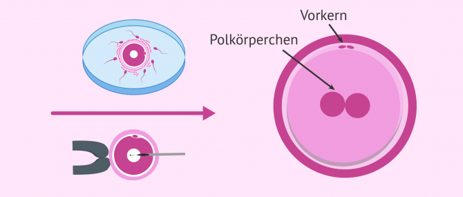 Imagen: Entwicklung des Embryos am Tag 1: Die Zygote