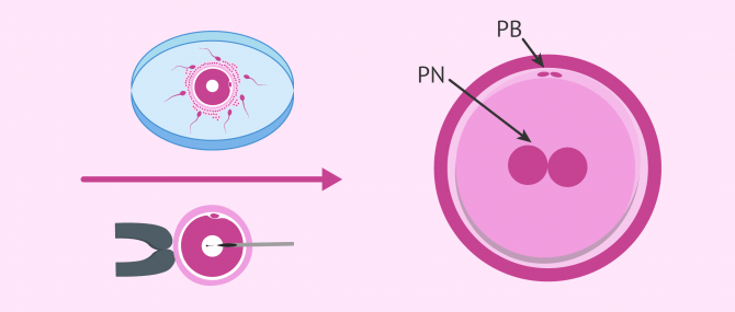 Imagen: zygote